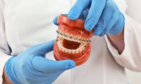 The Ultimate Guide to Finding a Dentist in Leicester and Understanding Teeth Braces The Ultimate Guide to Finding a Dentist in Leicester and Understanding Teeth Braces
