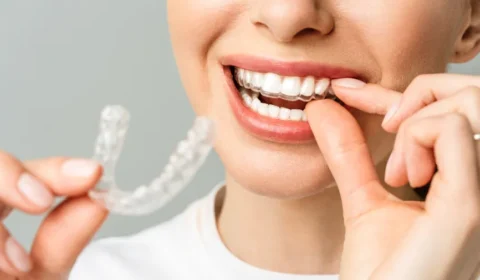Discover the Best Dentist and Invisalign Treatment Options in Leicester